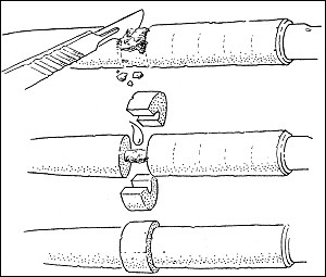 Reparation av korkhandtag